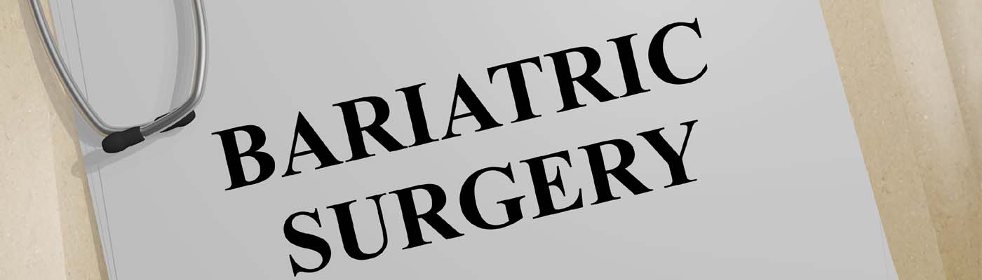 How you can have a successful bariatric surgery 